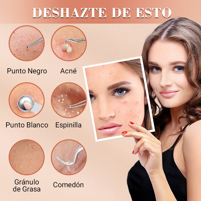 EXTRACTOR™- DE PUNTOS NEGROS Y GRANOS
