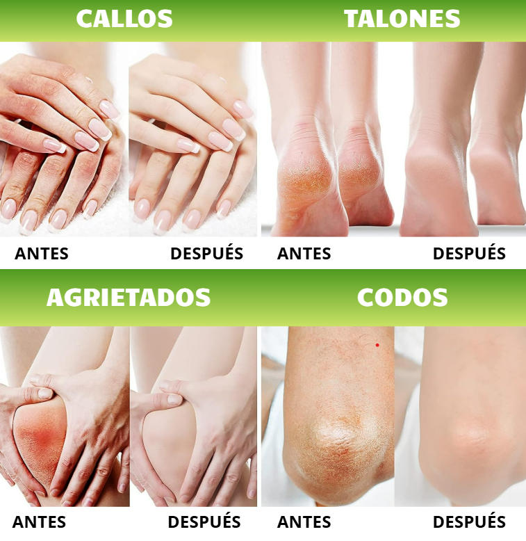 UREA CREAM-SUAVIDAD TOTAL™