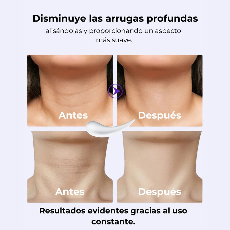 GOPURE™-REAFIRMANTE LIFTING PARA EL CUELLO