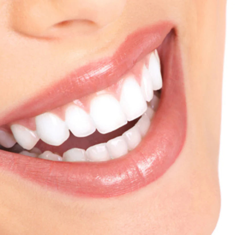 Moldable False Teeth ™ - Sonrisa Perfecta en Minutos