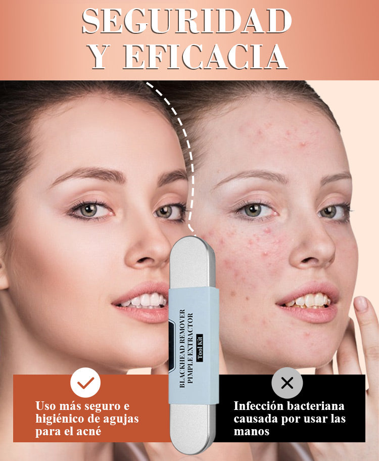 EXTRACTOR™- DE PUNTOS NEGROS Y GRANOS