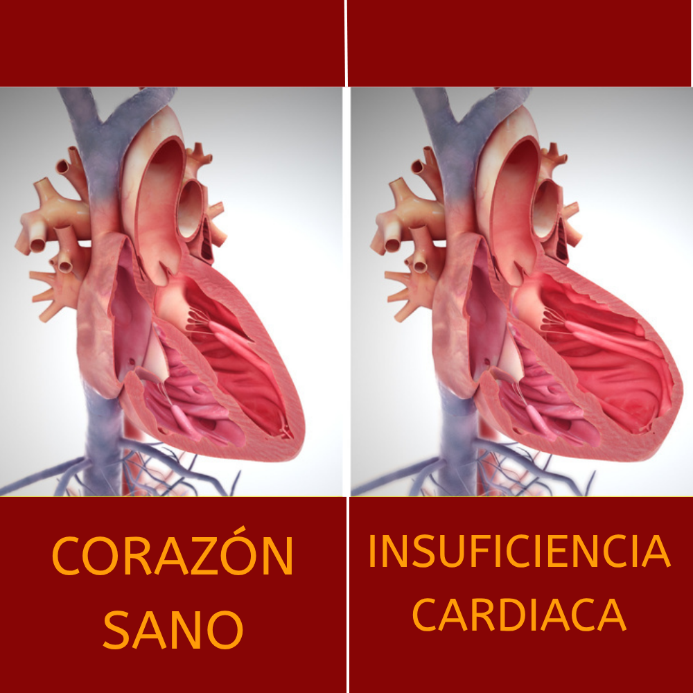 MEGARED®-PROTEGE TU CORAZÓN