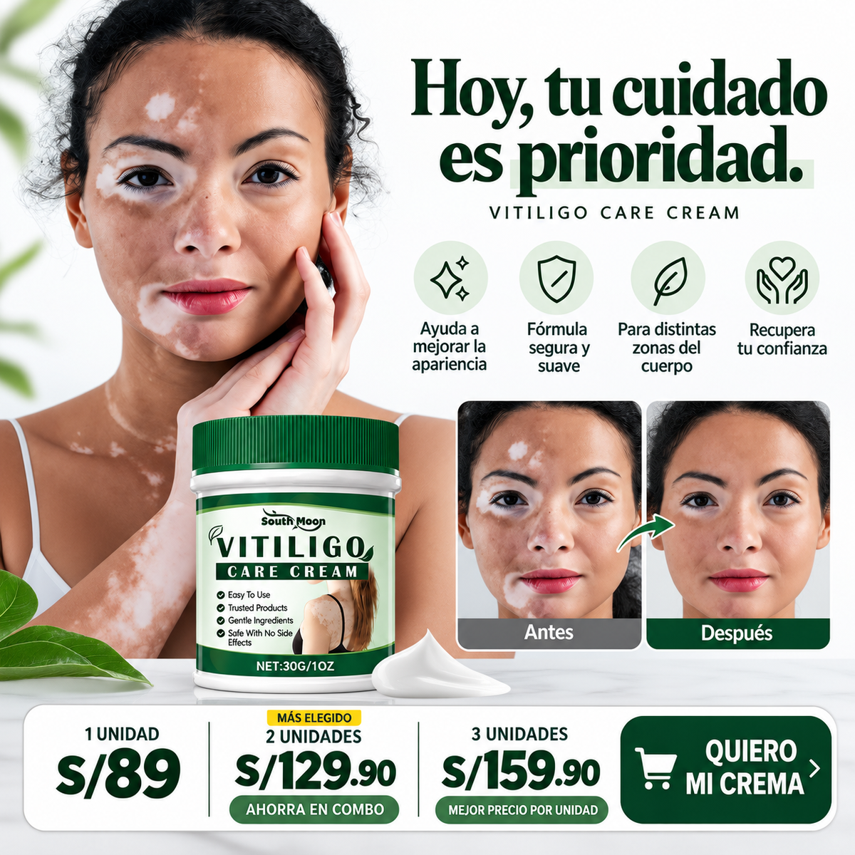 CREMA VITILIGO - ELIMINA MANCHAS BLANCAS