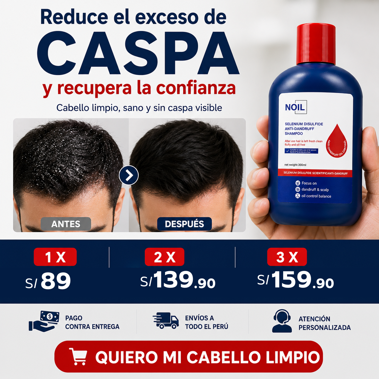 SHAMPOO NOIL - ELIMINA CASPA