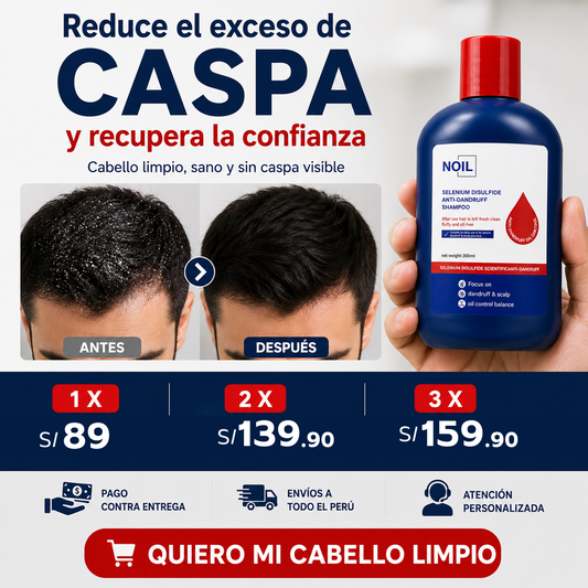 SHAMPOO NOIL - ELIMINA CASPA